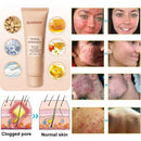 QUARXERY| EXFOLIANTE CORPORAL🫧~ACLARA LAS ZONAS NEGRAS DE LA PIEL!